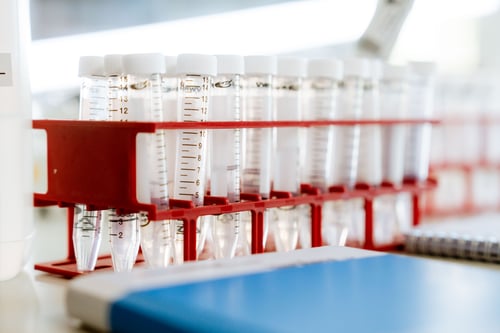 Why the PFAS Treatment Market is a Growing Opportunity for Investors, Industry, and the Planet